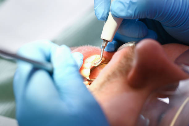 Best Broken or Chipped Tooth Repair in Nederland, CO
